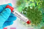 آخرین تغییرات حضوری یا مجازی بودن امتحانات دانشگاه‌ها