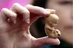 20درصد زوجین ایرانی نابارورند