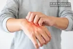 واکنش جالب باشگاه پرسپولیس به ابتلا سرژ اوریه به هپاتیت