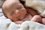 تولد دوقلوهای به‌هم چسبیده با قلب مشترک