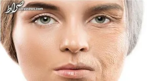 اینفوگرافی/ راهکارهایی برای رفع خشکی پوست و لب روزه‌داران