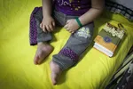 ۴۵ درصد کودکان مبتلا به کرونا هیچ علائمی ندارند