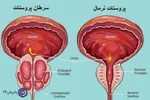 وقتی هوش‌مصنوعی به کمک تشخیص سرطان می‌آید