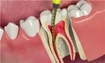 چرا جوش می‌زنیم؟