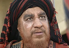 تصاویر/ اقدام احمقانه به‌بهانه عزاداری
