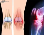 داروخانه‌ها مملو از دارو است/ کمبود‌ها طی ۲ ماه آتی برطرف می‌شود