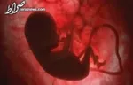 تولد ۱۱ نوزاد سالم از والدین مبتلا به اچ. آی. وی در شهرستان همدان