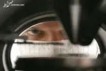 آبله میمون را بشناسیم