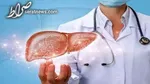 کبد چرب را با نسخه طب سنتی درمان کنید