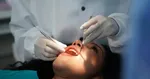 تاثیر بیماری‌ لثه در خطر ابتلا به آلزایمر