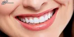 چگونه دندان ها را در منزل جرم گیری و سفید کنیم