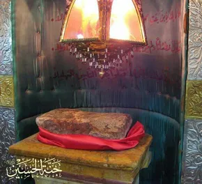 عکس/ ادعای جوانی که کلیه‌اش را به اکبر عبدی اهدا کرد
