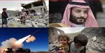 احتمال مرگ 85 هزار کودک یمنی بر اثر گرسنگی و قحطی