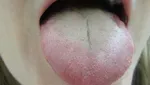 بعد از صبحانه مسواک نزنید