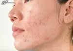 مواد غذایی که صورت‌تان را زیبا می‌کنند