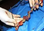 این خوراکی برای کم خونی معجزه می‌کند