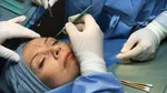 ماجرای انتشار عکسی از احمدی‌نژاد با صورت کبود و ورم‌کرده چه بود؟ + عکس