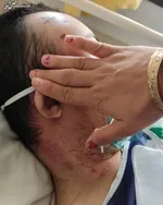 ضرب و شتم یک معلول در آسایشگاه| ضارب اخراج شد