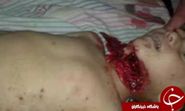 جنایت تروریست های سوری در به شهادت رساندن کودک 7 ساله