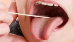 هشدار جدی به کسانی که هسته زردآلو می‎‌خورند