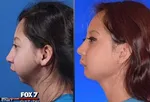 مسابقه زیباترین زن با جراحی چال گونه!+تصاویر