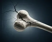 چرا با افزایش سن، سلامت استخوان‌ها تهدید می‌شود؟